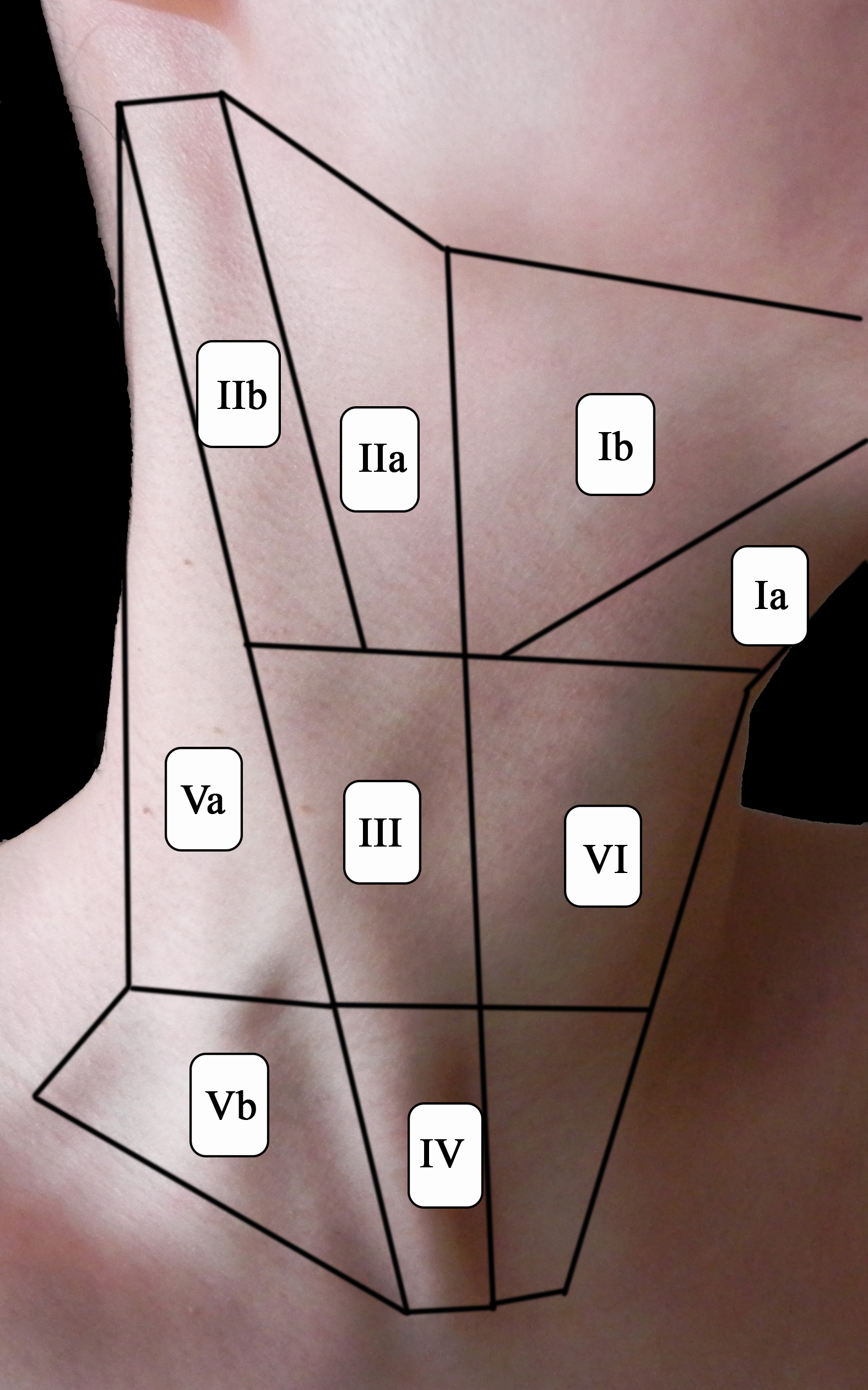 An external file that holds a picture, illustration, etc., usually as some form of binary object. The name of referred object is rmmj-5-2-e0008-g001.jpg